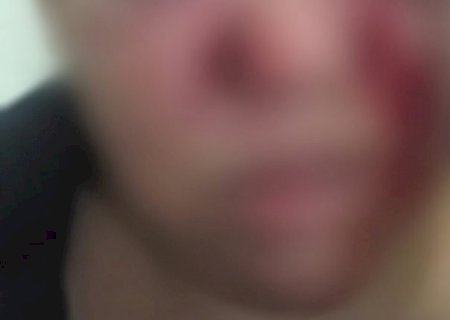 Ex não aceita fim de casamento e corta cabelo de mulher com facão