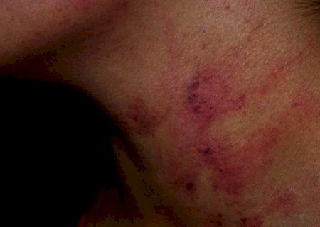 Mulher é espancada e mantida em cárcere pelo marido, mas consegue fugir ao pular o muro em MS