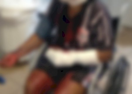 Jovem &eacute; cercada e ferida por golpes de fac&atilde;o em Dourados