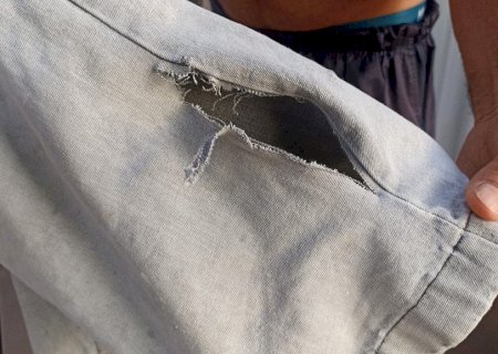 Idoso é atacado por cachorro enquanto fazia caminhada no centro de Nova Andradina