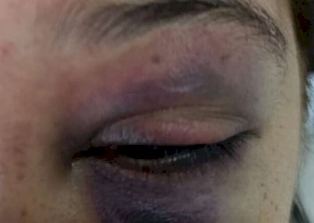 Mulher chega no trabalho com olho roxo, patr&atilde;o descobre agress&atilde;o e chama pol&iacute;cia