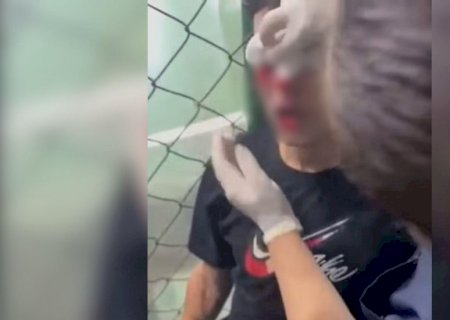 Bomba explode em vestiário de partida de futsal e perfura olho de atleta no RJ