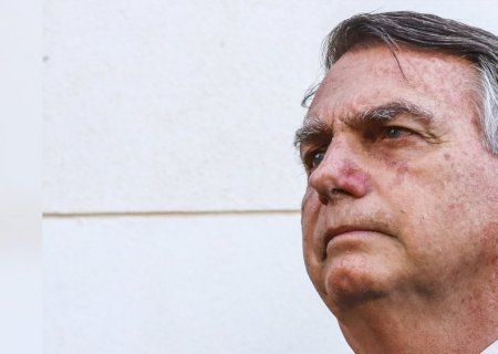 Apneia do sono e CPAP: entenda distúrbio que afeta Bolsonaro e o tratamento