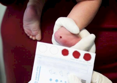 MS expande a realiza&ccedil;&atilde;o do Teste do Pezinho Ampliado