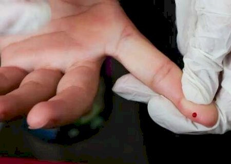 Brasil elimina transmiss&atilde;o vertical da hepatite B; MS segue tend&ecirc;ncia